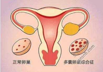 成都代孕中心_成都供卵代孕_女性生殖系统的保养很重要，不可忽视